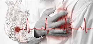 Ecg at home